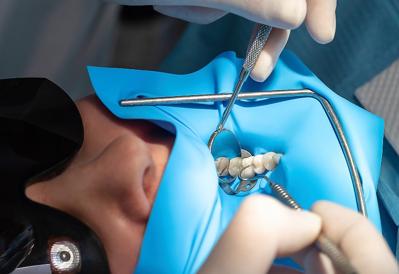 A patient undergoing restorative dental treatment with a rubber dam in a clinic in Warrenville, IL